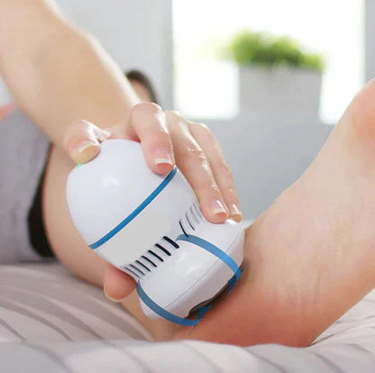 Rechargeable Callus Remover